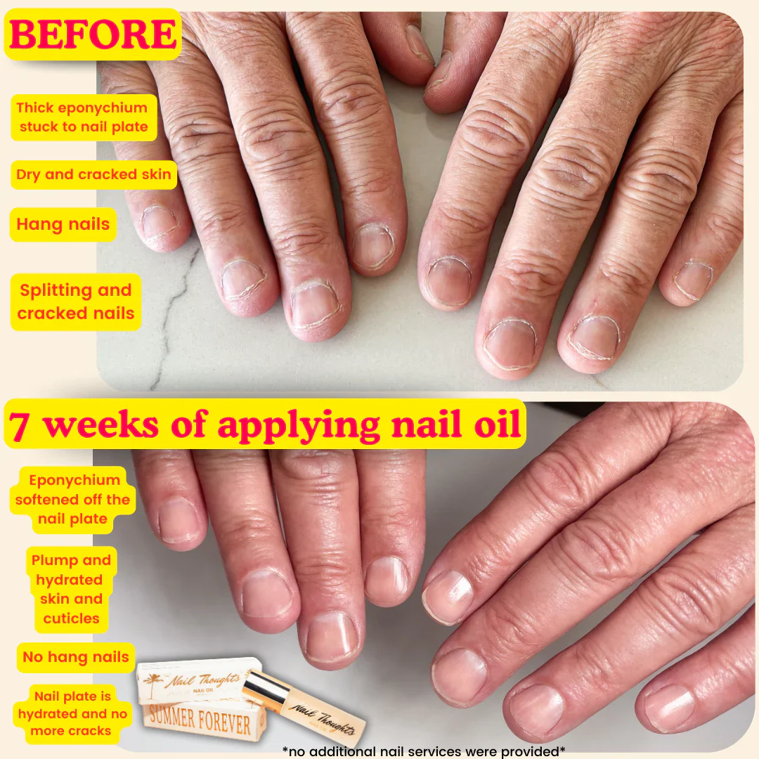 Nail Thoughts - Summer Forever Nail Oil 10ml - Image 3