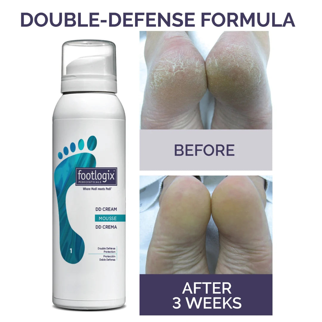 Footlogix - DD Cream Mousse, 125ml - Image 2